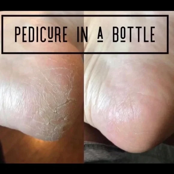 - (2) TWO Epoch NuSkin Sole Solution foot treatment